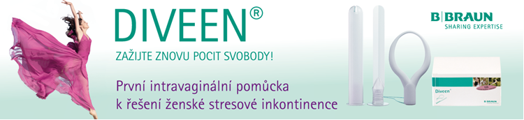 Ženská stresová inkontinence