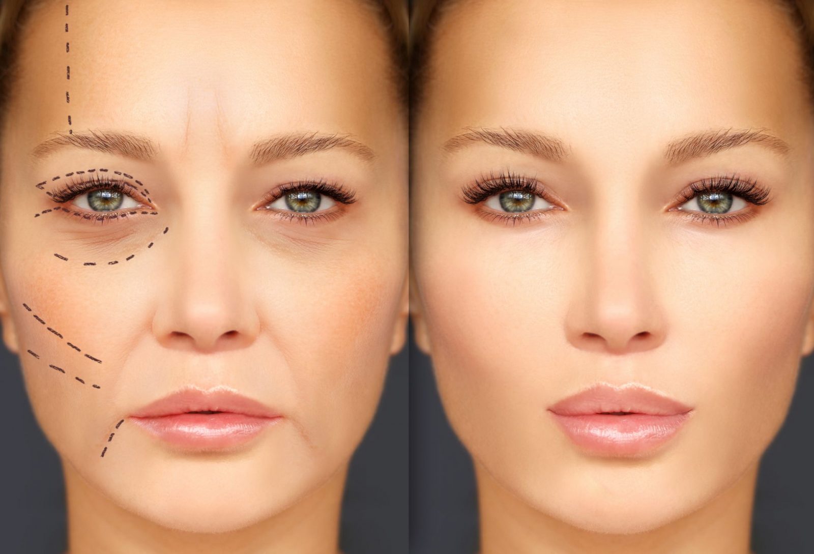Optimal Plus F - PRO Collagen