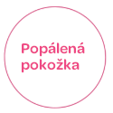 Popálená pokožka