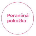 Poraněná pokožka