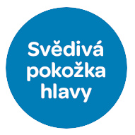 Svědivá pokožka hlavy